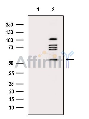 AMIGO3 Antibody - Western blot analysis of extracts from K562 cells(serum starvation treatment), using AMIGO3 Antibody.