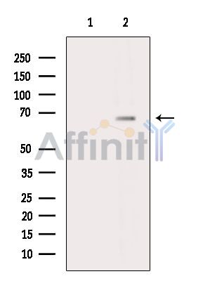 LRRTM4 Antibody - Western blot analysis of extracts from MCF7 cells(serum starvation treatment), using LRRTM4 Antibody.
