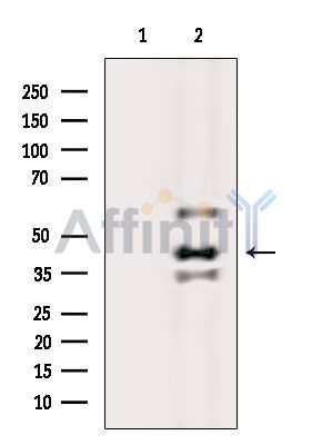 TUFT1 Antibody - Western blot analysis of extracts from Rat lung, using TUFT1 Antibody.