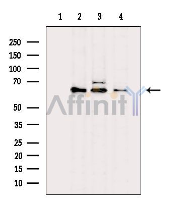 API-5 Antibody - Western blot analysis of extracts from various samples, using API-5 Antibody.