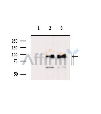 CDH8 Antibody - Western blot analysis of extracts from various samples, using CDH8 Antibody.