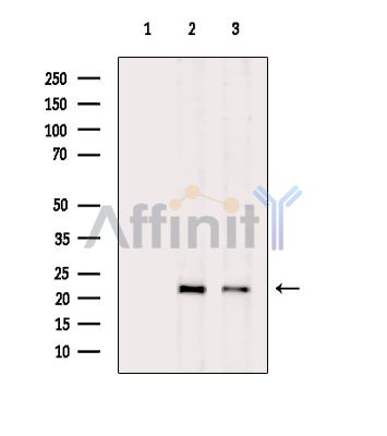 CBLN1 Antibody - Western blot analysis of extracts from various samples, using CBLN1 Antibody.