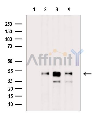 DNAJC5 Antibody - Western blot analysis of extracts from various samples, using DNAJC5 Antibody.