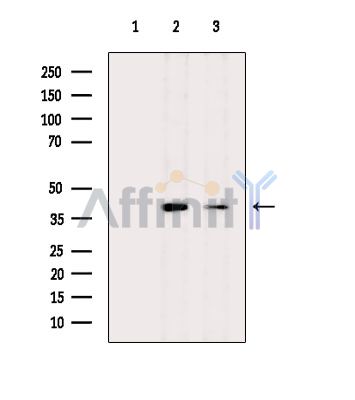 SLC24A6 Antibody - Western blot analysis of extracts from various samples, using SLC24A6 Antibody.