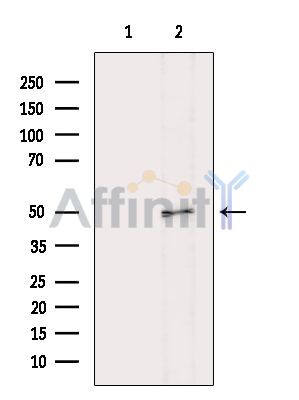 ALDH3A1 Antibody - Western blot analysis of extracts from HepG2 cells(heat-shock treatment), using ALDH3A1 Antibody.