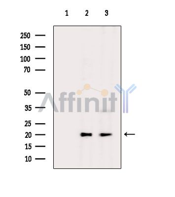 CAPNS2 Antibody - Western blot analysis of extracts from various samples, using CAPNS2 Antibody.
