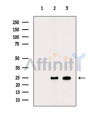 TCEAL8 Antibody - Western blot analysis of extracts from various samples, using TCEAL8 Antibody.