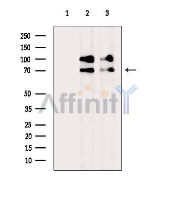 Involucrin Antibody - Western blot analysis of extracts from various samples, using Involucrin Antibody.