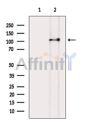 Phospho-NLRP3 (Ser198) Antibody - Western blot analysis of extracts from K562 cells(UV treatment), using Phospho-NLRP3 (Ser198) Antibody.