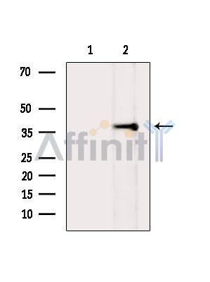 Phospho-RAD51 (Tyr54) Antibody - Western blot analysis of extracts from K562 cells(UV treatment), using Phospho-RAD51 (Tyr54) Antibody.