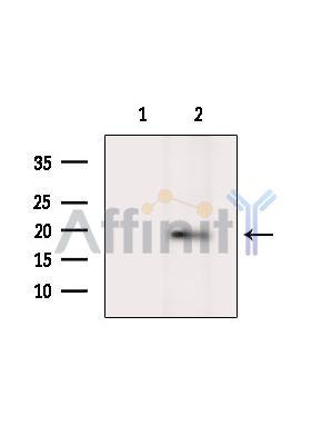 Phospho-Histone H3 (Ser28) Antibody - Western blot analysis of extracts from MCF7 cells(LPS 4h treatment), using Phospho-Histone H3 (Ser28) Antibody.