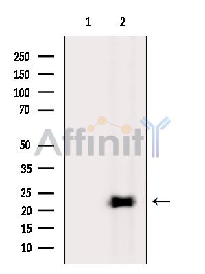 TMEM199 Antibody - Western blot analysis of extracts from Mouse liver, using TMEM199 Antibody.