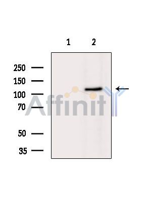 NALP2 Antibody - Western blot analysis of extracts from K562 cells(Lps treatment), using NALP2 Antibody.