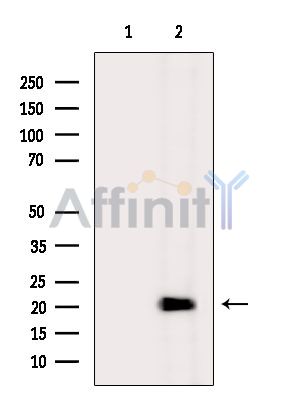 REG1 alpha Antibody - Western blot analysis of extracts from Mouse liver, using REG1 alpha Antibody.