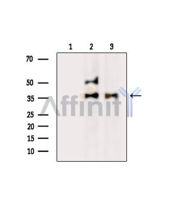 C12orf29 Antibody - Western blot analysis of extracts from various samples, using C12orf29 Antibody.