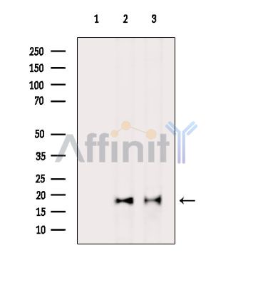 ORMDL3 Antibody - Western blot analysis of extracts from various samples, using ORMDL3 Antibody.