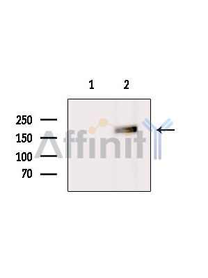 SHPRH Antibody - Western blot analysis of extracts from K562 cells(Lps treatment), using SHPRH Antibody.