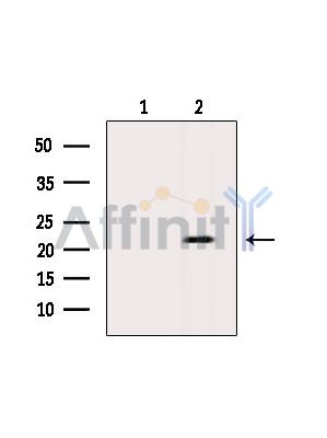 SSX6 Antibody - Western blot analysis of extracts from Rat lung, using SSX6 Antibody.