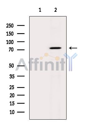 SLCO3A1 Antibody - Western blot analysis of extracts from K562 cells(UV treatment), using SLCO3A1 Antibody.