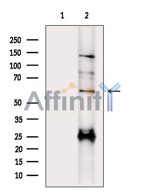 MEPE Antibody - Western blot analysis of extracts from PC12 cells(heat-shock treatment), using MEPE Antibody.