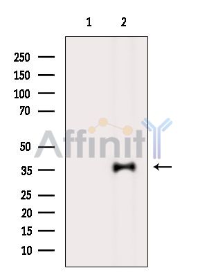 C1orf198 Antibody - Western blot analysis of extracts from Mouse liver, using C1orf198 Antibody.