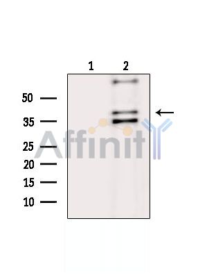 PCMTD1 Antibody - Western blot analysis of extracts from K562 cells(Lps treatment), using PCMTD1 Antibody.