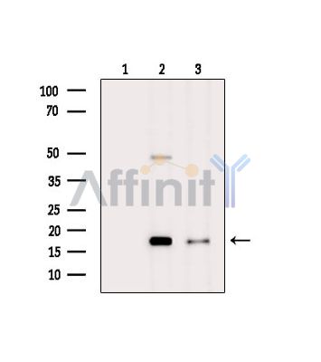 FAM162B Antibody - Western blot analysis of extracts from various samples, using FAM162B Antibody.