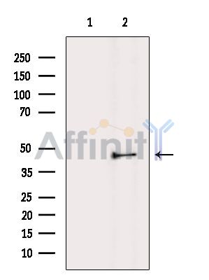 SMYD5 Antibody - Western blot analysis of extracts from MCF7 cells(heat-shock treatment), using SMYD5 Antibody.