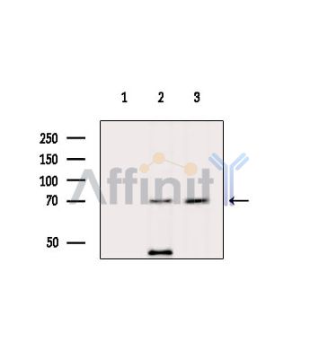 TRMT1 Antibody - Western blot analysis of extracts from various samples, using TRMT1 Antibody.