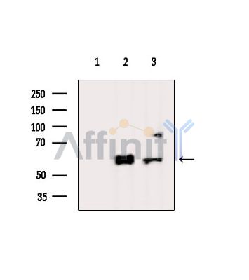 TRABD Antibody - Western blot analysis of extracts from various samples, using TRABD Antibody.
