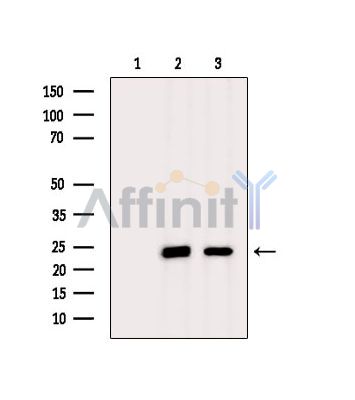 VMA21 Antibody - Western blot analysis of extracts from various samples, using VMA21 Antibody.