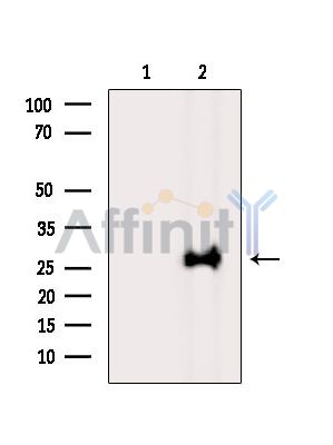 THAP10 Antibody - Western blot analysis of extracts from Mouse liver, using THAP10 Antibody.