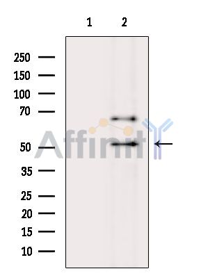 TRMT61B Antibody - Western blot analysis of extracts from MCF7 cells(serum starvation treatment), using TRMT61B Antibody.