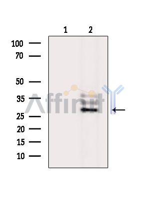 TBCB Antibody - Western blot analysis of extracts from K562 cells(Lps treatment), using TBCB Antibody.