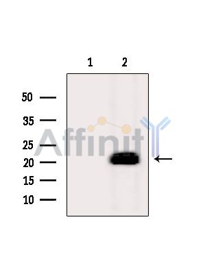 MYL12A Antibody - Western blot analysis of extracts from Mouse liver, using MYL12A Antibody.