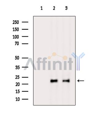 DUSP14 Antibody - Western blot analysis of extracts from various samples, using DUSP14 Antibody.