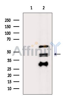 K1HB Antibody - Western blot analysis of extracts from K562 cells(Lps treatment), using K1HB Antibody.