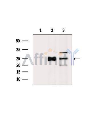 DNAL4 Antibody - Western blot analysis of extracts from various samples, using DNAL4 Antibody.