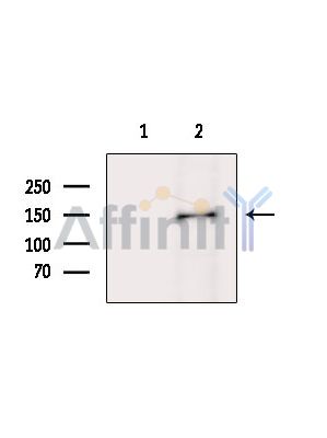MYO3B Antibody - Western blot analysis of extracts from Mouse liver, using MYO3B Antibody.