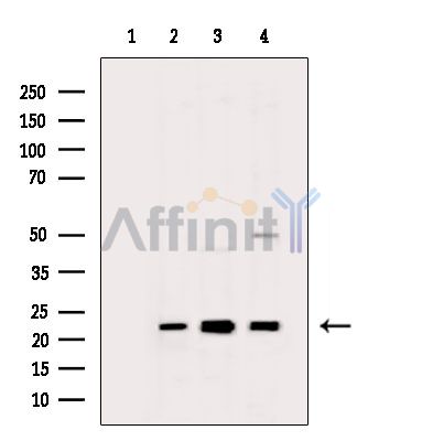 BTF3L4 Antibody - Western blot analysis of extracts from various samples, using BTF3L4 Antibody.