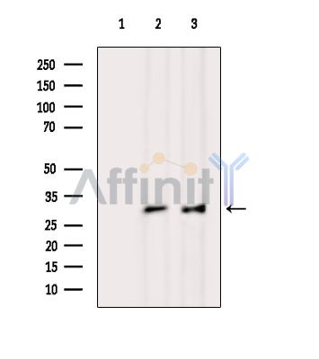RNF170 Antibody - Western blot analysis of extracts from various samples, using RNF170 Antibody.