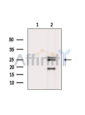 TMEM186 Antibody - Western blot analysis of extracts from K562 cells(heat-shock treatment), using TMEM186 Antibody.