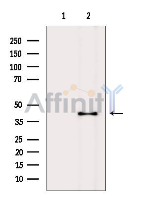 LMAN2 Antibody - Western blot analysis of extracts from MCF7 cells(heat-shock treatment), using LMAN2 Antibody.