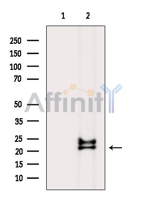 FAM210B Antibody - Western blot analysis of extracts from K562 cells(heat-shock treatment), using FAM210B Antibody.