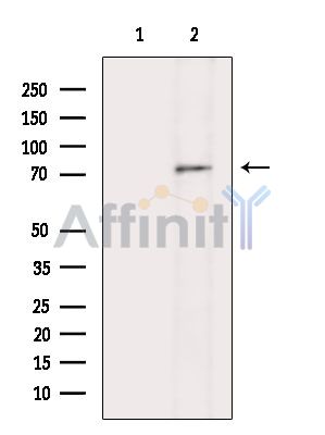 SLCO2B1 Antibody - Western blot analysis of extracts from K562 cells(heat-shock treatment), using SLCO2B1 Antibody.