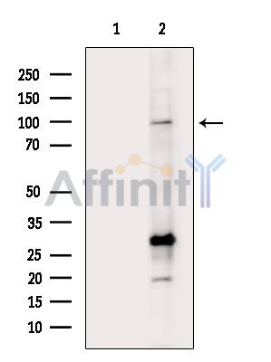 HMGCR Antibody - Western blot analysis of extracts from HepG2 cells, using HMGCR Antibody.