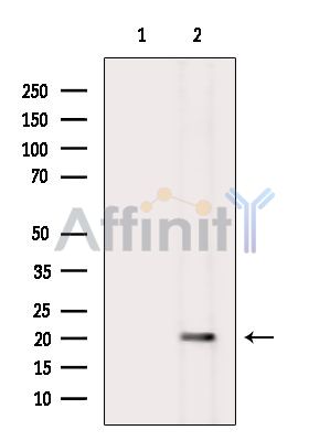 TCR beta Antibody - Western blot analysis of extracts from Mouse liver, using TCR beta Antibody.