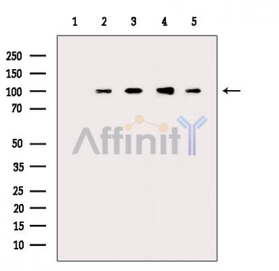 NLRP3 Mouse monoclonal Antibody - Western blot analysis of extracts from various samples, using NLRP3 Mouse monoclonal Antibody.