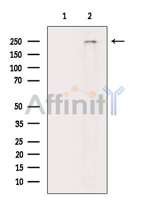 CCDC131 Mouse Monoclonal Antibody - Western blot analysis of extracts from Rat lung, using CCDC131 Mouse Monoclonal Antibody.