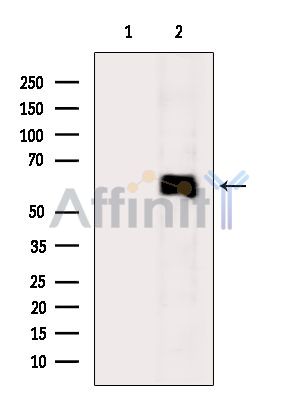 AMPK alpha Mouse Monoclonal Antibody - Western blot analysis of extracts from Mouse lung, using AMPK alpha Mouse Monoclonal Antibody.